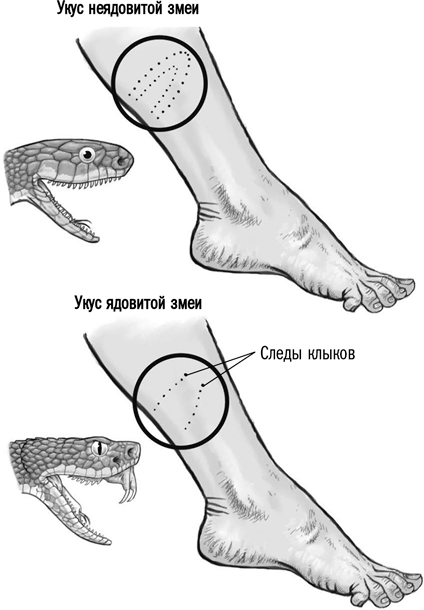 Как понять, что вас укусила ядовитая змея