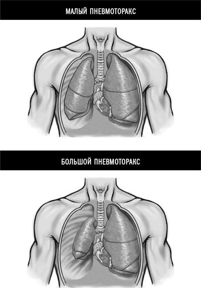 Признаки