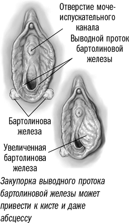 Кровотечение