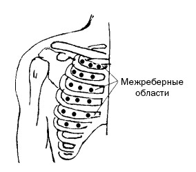 Зона грудной клетки