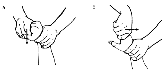 Рис. 75. Пассивные движения в пястно-фаланговых суставах: а – сгибание; б – разгибание пальцев