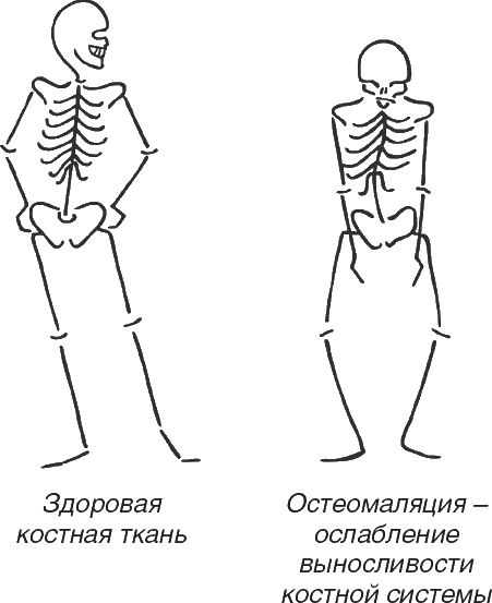 8. Крепкие кости