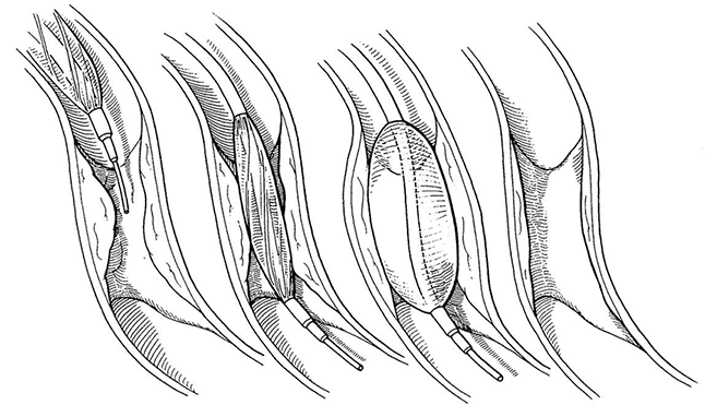 Рисунок 5.1.