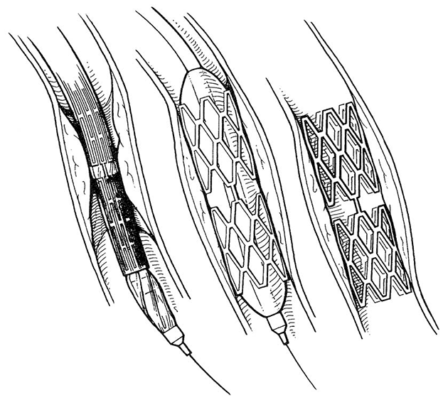 Рисунок 5.2.