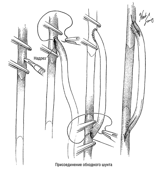 Рисунок 5.4.