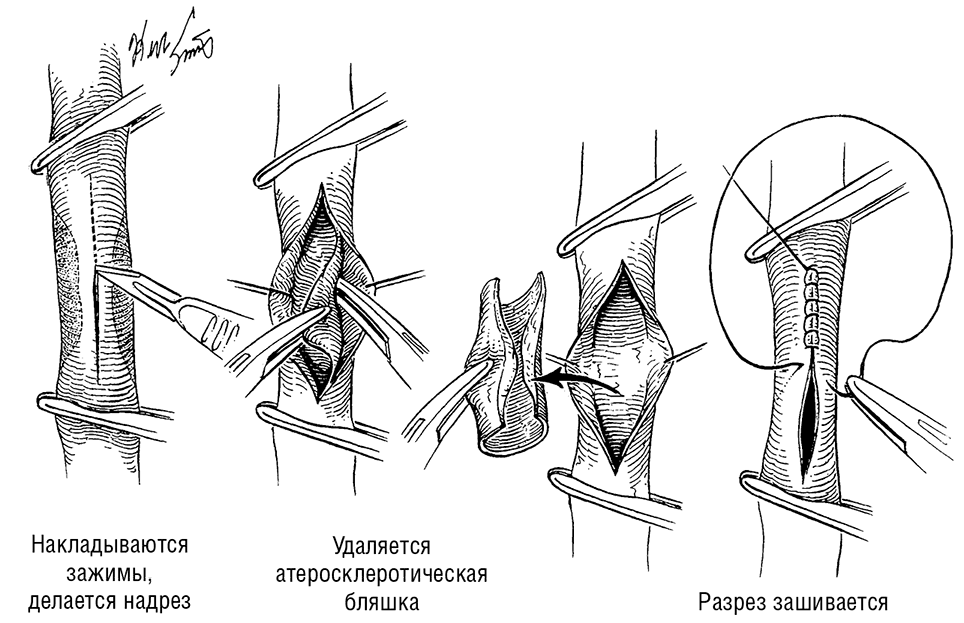 Рисунок 5.5.