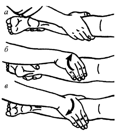 Рис. 25. Поперечное рашинание одной рукой: а – фаза фиксации; б – фаза сдавления: в – раздавливание (раскатывание)