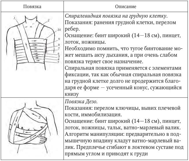 Схема классификации повязок