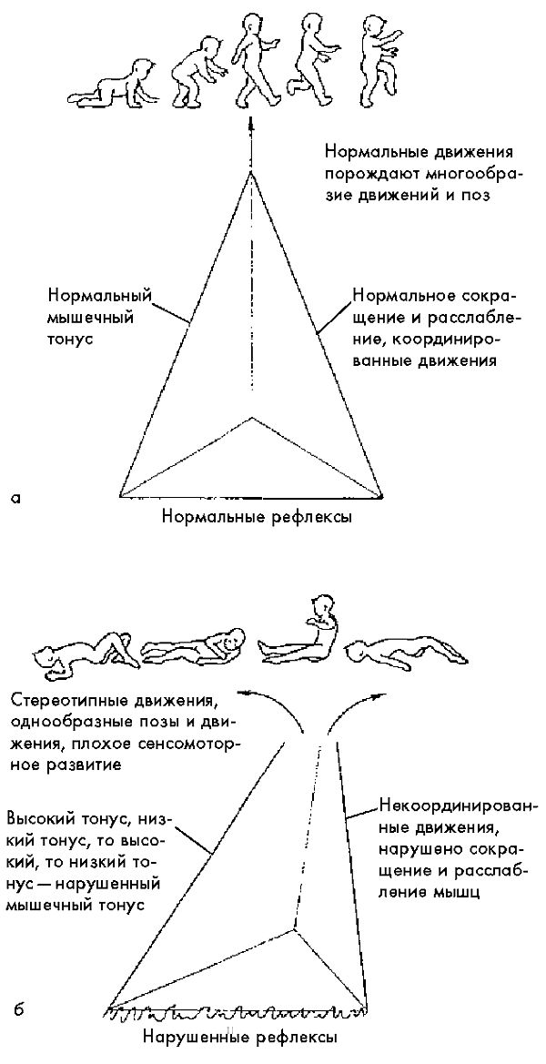 Рис. 5.1. а – <a href='https://med-tutorial.ru/m-lib/b/book/2181632884/29' target='_self'>физическое развитие</a> на фоне нормальных мышечного тонуса, <a href='https://med-tutorial.ru/m-lib/b/book/4099097630/56' target='_self'>постуральных рефлексов</a> и т. д. Формируются нормальные движения и поза; б – физическое развитие на фоне нарушенных мышечного тонуса, <a href='https://med-tutorial.ru/m-lib/b/book/4099097630/56' target='_self'>постуральных рефлексов</a> и т. д. Формируются стереотипные и однообразные движения.