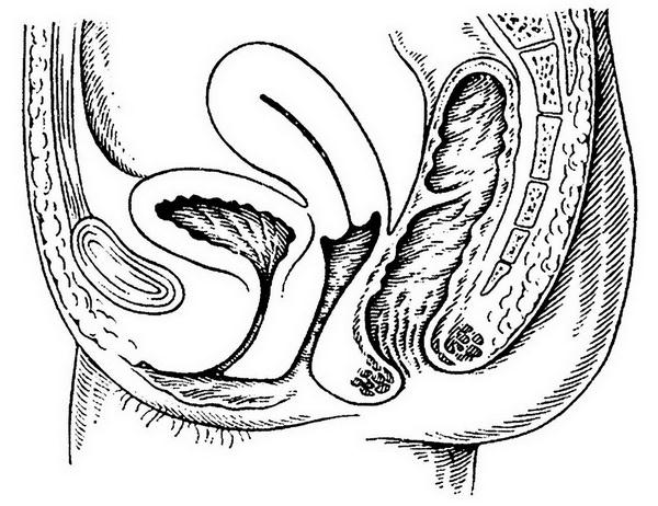 Глава 18. Неправильное положение половых органов